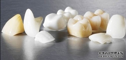 全瓷牙,全瓷牙价格